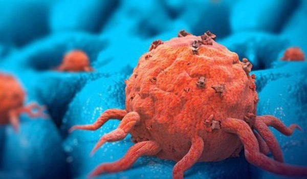 Các rối loạn tiêu hóa ở người bệnh ung thư và cách khắc phục